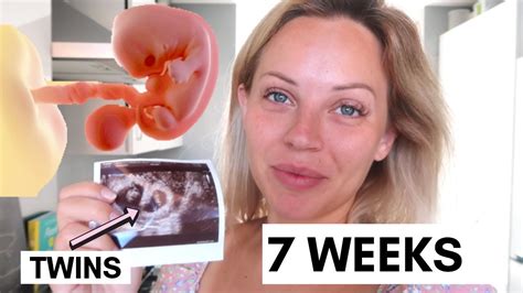 7 WEEKS PREGNANT WITH TWINS | 7 WEEK PREGNANCY UPDATE | Lucy Jessica ...