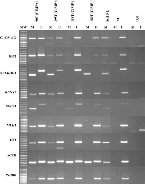 Figure 1 from The CpG Island Methylator Phenotype Correlates with Long ...