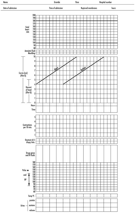 5.2 Monitoring labour and delivery | MSF Medical Guidelines