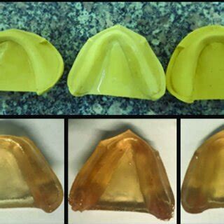 A, completely edentulous mandibular jaw models with square, tapered ...