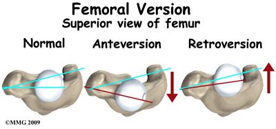 Aaron's Blog: Assessing Hip Rotation