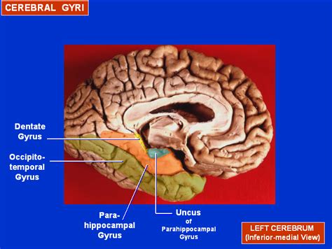 The Most Inferior Portion of the Diencephalon Is the