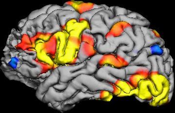 fMRI - Noninvasive Imaging | Ned T. Sahin