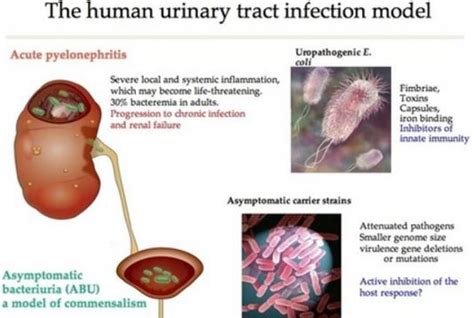 Urosepsis - ICD9 Code, What is?, Pathophysiology, Symptoms