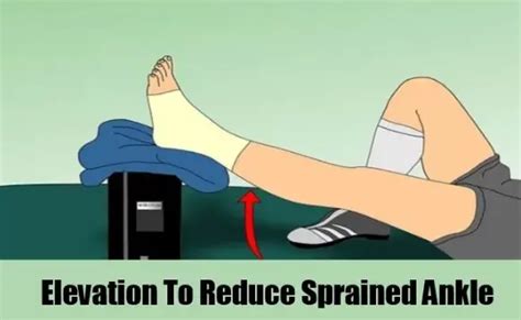 ankle elevation