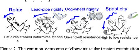 Cogwheel Rigidity