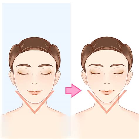 Can I Get a V-Shape Face Without Surgery? Answered by Beverly Wilshire Medical Centre | Erufu Care