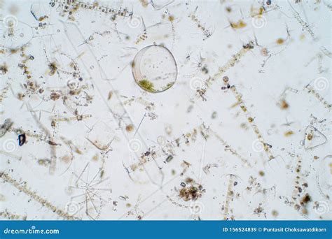 Marine Aquatic Plankton Under Microscope View Stock Image - Image of ...