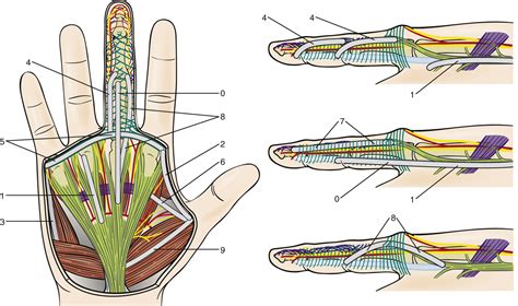 Needle Aponeurotomy | Musculoskeletal Key