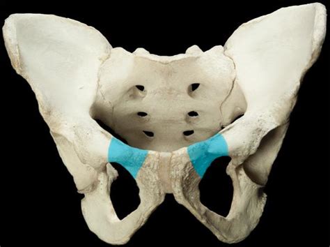 Biology 264 > Groesbeck > Flashcards > Coxal Bone, Ischium, Pubis | StudyBlue