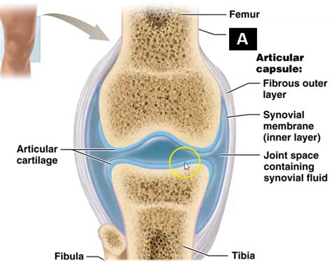 Name the structure of the Synovial Joint labeled "A":