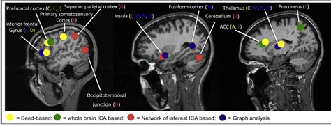 Main brain areas implicated in resting-state functional MRI. Diagram of ...