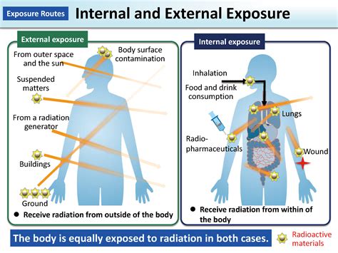 Internal and External Exposure [MOE]