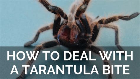 How To Deal With A Tarantula Bite: What To Do And When To Get Help