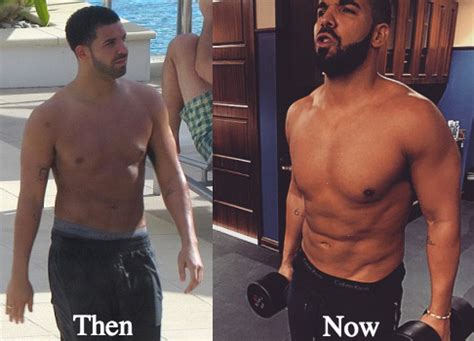 Drake Plastic Surgery Before and After Photos