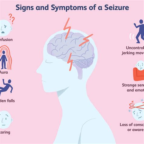 Seizures, Signs And Symptoms, Multiple Sclerosis, Caring, Aura