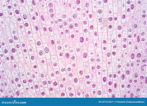 Mitosis Cell of Root Tip of Onion Under the Light Microscope Stock ...