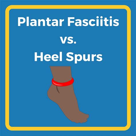 Plantar Fasciitis Heel Spur Order Discounts, Save 42% | jlcatj.gob.mx