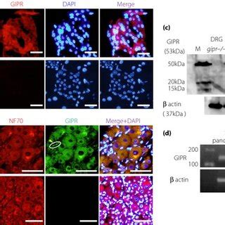 Expressions of gastric inhibitory polypeptide receptor (GIPR) in dorsal ...