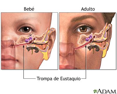 Infección crónica del oído: MedlinePlus enciclopedia médica