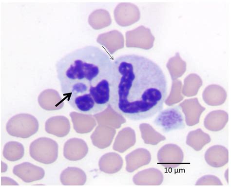 Feline Anaplasmosis • MSPCA-Angell