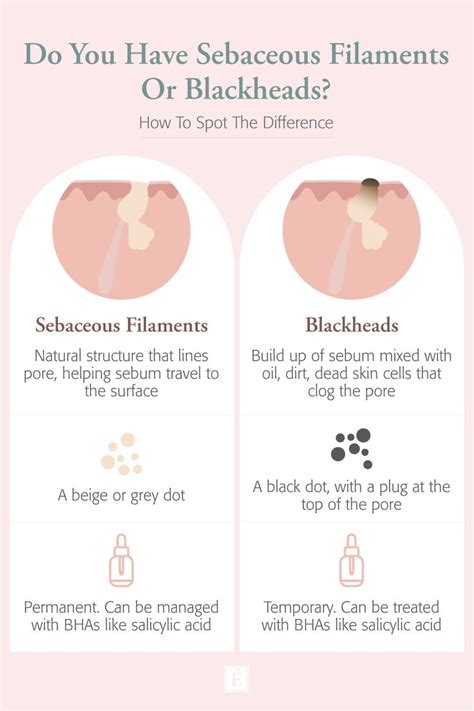 Sebaceous Filaments Vs. Blackheads - What’s The Difference? | Sebaceous filaments, Eminence ...