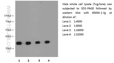 PTGLab - GAPDH Antibody 60004-1-Ig