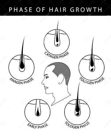 Phase of Human Hair Growth Cycle Catagen, Telogen, Early, Anagen Phase, Illustration on White ...