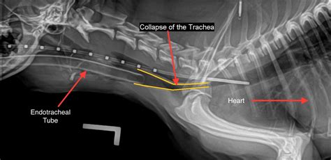 Tracheal Collapse: Medical Management Versus Implantable Stents