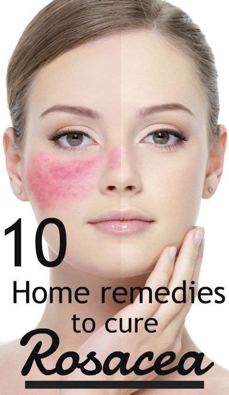 Rosacea is a chronic skin condition that usually affects the face ...