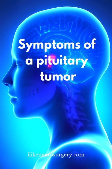 Symptoms of pituitary tumors | I like neurosurgery | Brain tumor awareness, Brain tumor symptoms ...