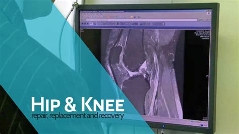 Hip & Knee | ACL Reconstruction