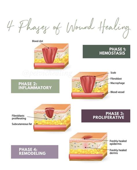 Surgical Wound Healing Stages