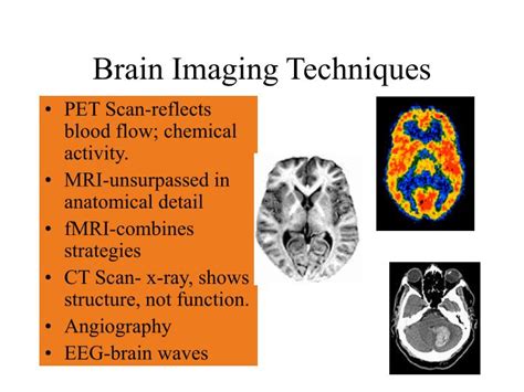 PPT - Brain PowerPoint Presentation - ID:3682966