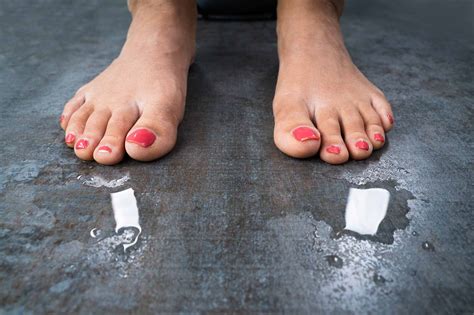 Sweaty Feet: Causes, Treatments and Information | Podiatrist in Visalia