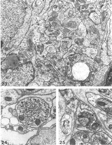 Nerve terminals with clear transmitter vesicles making synaptic... | Download Scientific Diagram