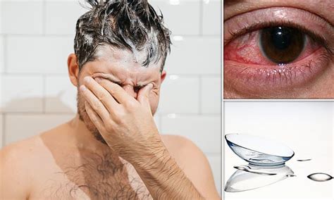 Wearing contact lenses in the shower raises risk of cornea infection up to SEVEN-fold