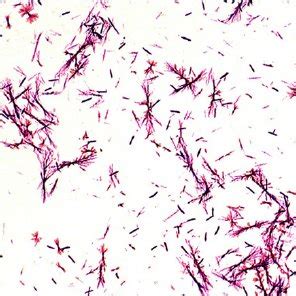 Light microscope observation of Proteus mirabilis PCM 543 culture ...