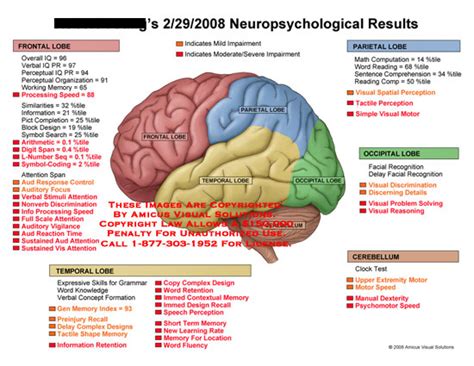 List of neurological deficits along with color coded brain.