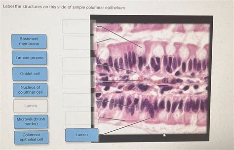 Solved Simple Columnar Epithelium Features Label the | Chegg.com