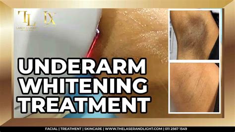 Dark Underarm Whitening Treatment⚡️[The Laser & Light Medical] - YouTube