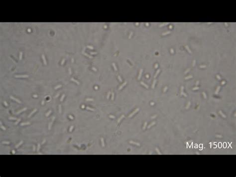 [最も好ましい] e coli under microscope 10x 148061-What does e coli look like ...