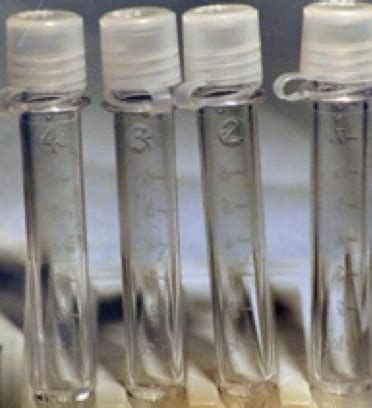 Cerebral Spinal Fluid Analysis... Variations with Age