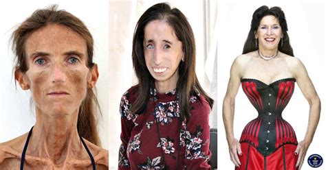 Discover the Top 10 Skinniest People in the World: Unbelievable Records Revealed - Flash Uganda ...