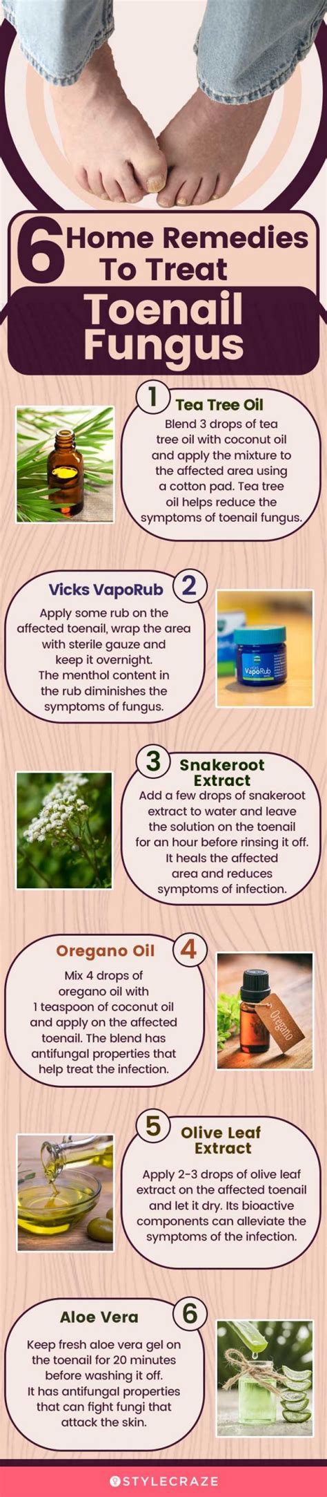 Distal Subungual Onychomycosis Home Remedies