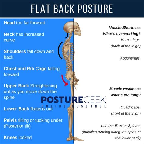 How To Know You Have Flat Back Posture | PostureGeek.com