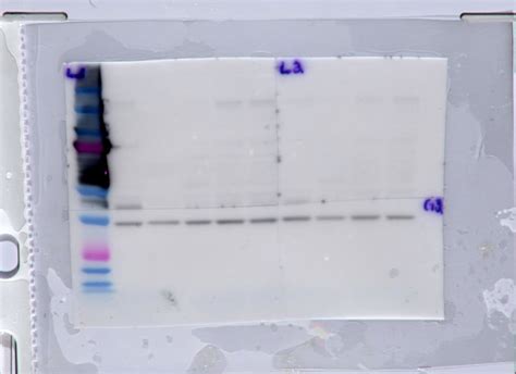 High background/smearing around protein ladder on western blot ...