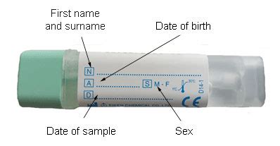 Stool sample instructions nhs