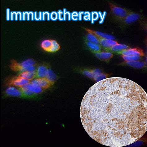 Immunotherapeutic Target Identification - CHOP Diskin Lab