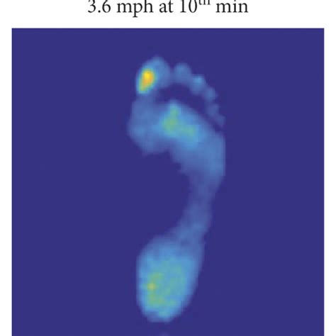 Examples of plantar pressure images after different walking speeds ...